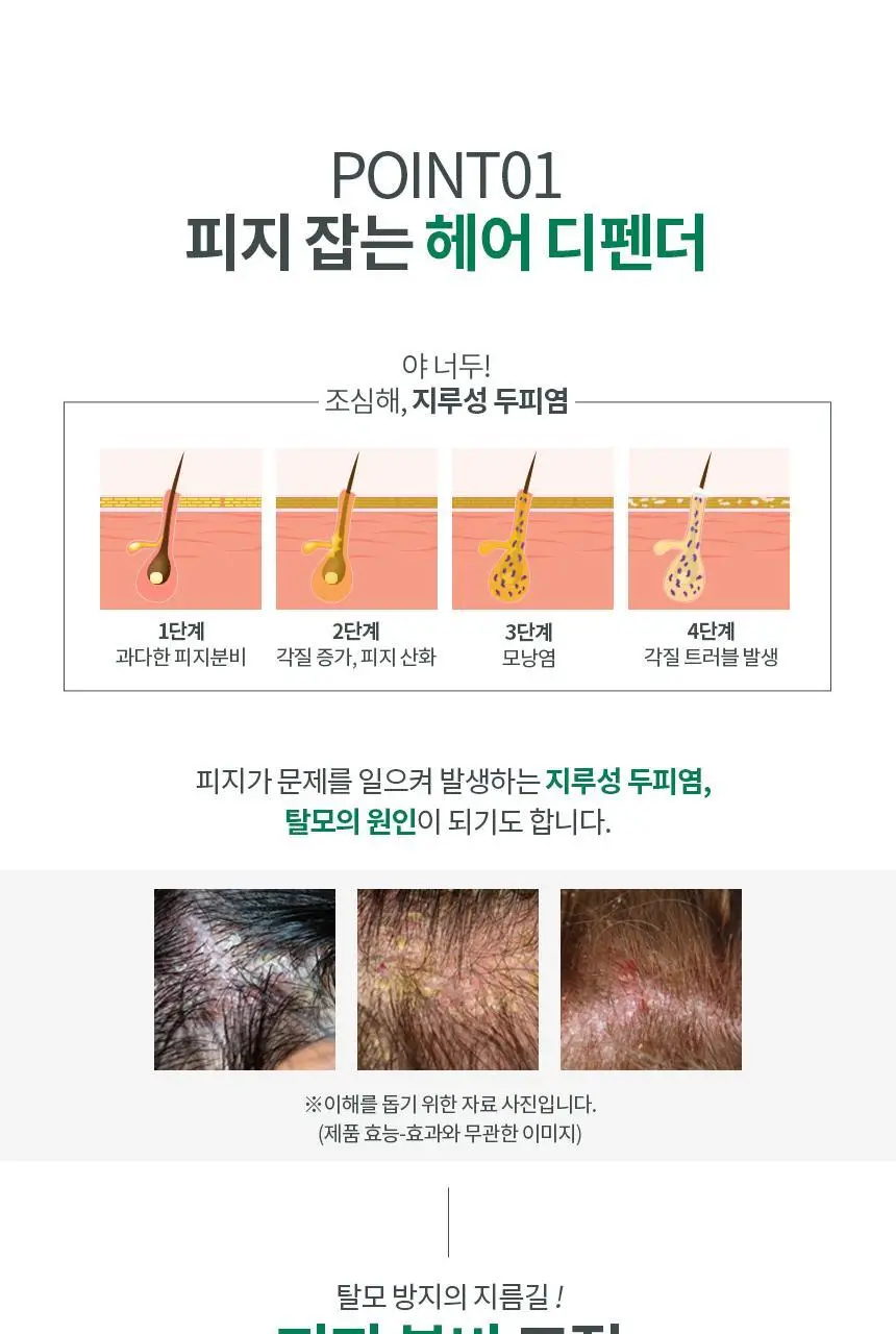 스웨거 헤어 디펜더 안티헤어로스 샴푸 490ml [탈모증상완화] 상세페이지 12